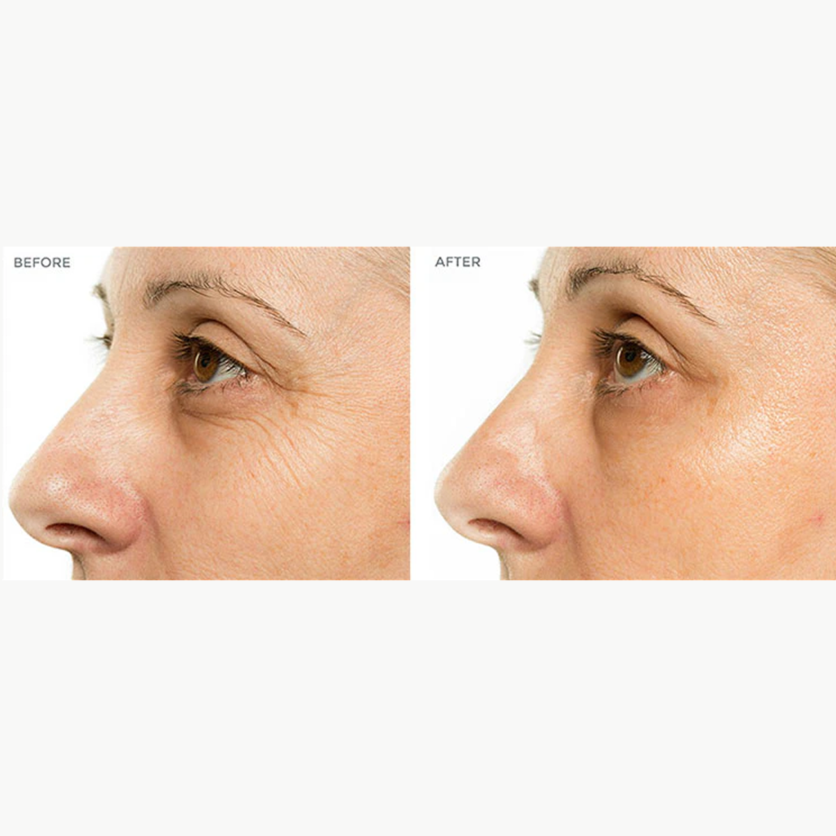 Chuda™ Healing Hydrating Cream